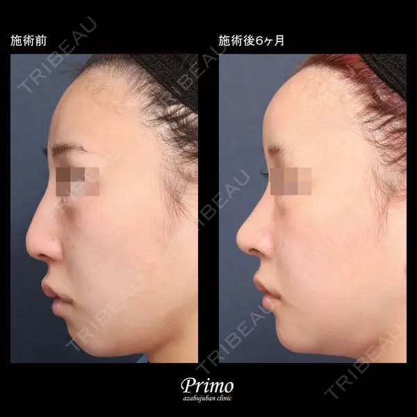 プリモ麻布十番クリニック 大場教弘医師の症例