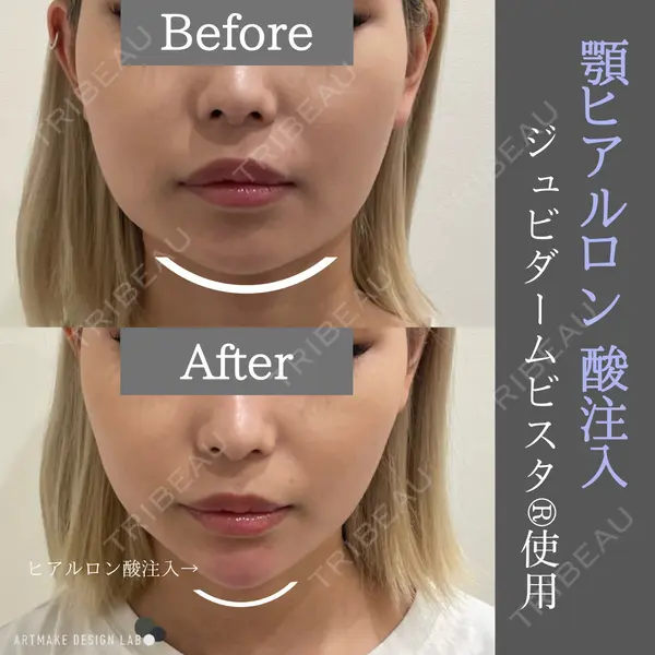 ARTMAKE DESIGN LAB 【アートメイクデザインラボ】の症例