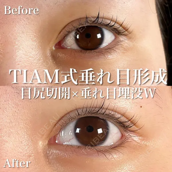 TIAM CLINIC GINZA 谷口 弘樹医師の症例