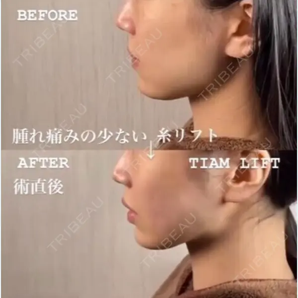TIAM CLINIC GINZA 谷口 弘樹医師の症例