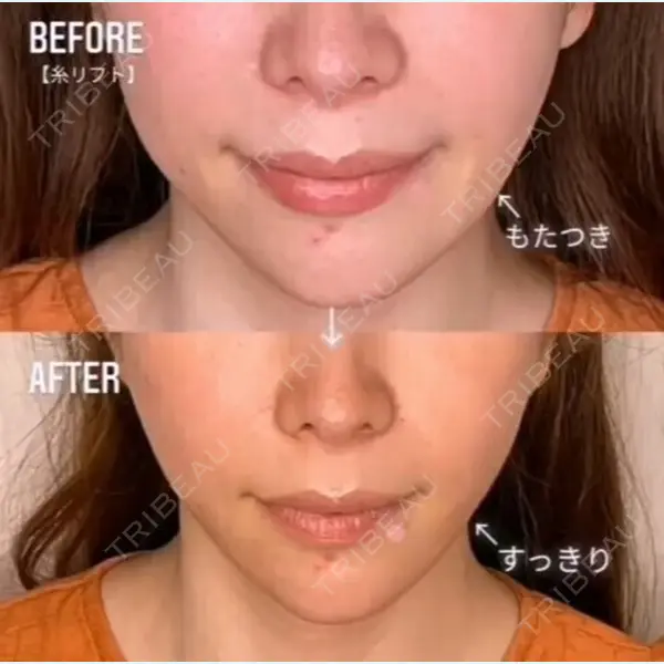TIAM CLINIC GINZA 谷口 弘樹医師の症例