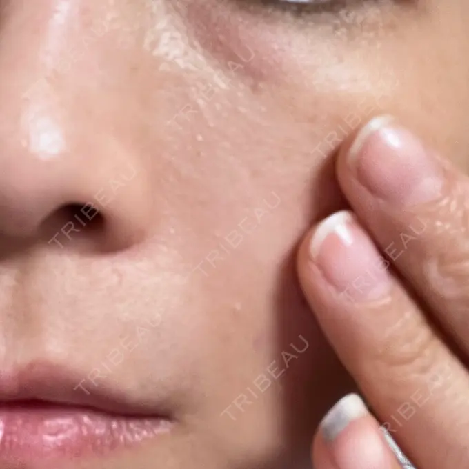 糸リフト 東京シンデレラ美容外科 池袋院 DAY 12 メイン用