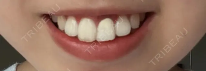 セラミック オーラルビューティークリニック クラリス審美歯科・矯正歯科 DAY 1 メイン用