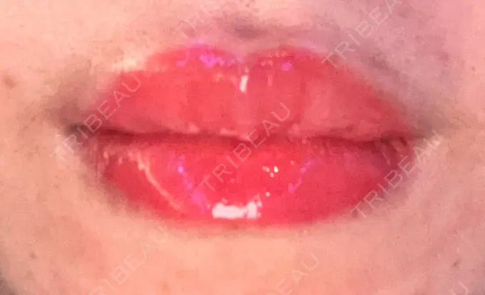 アートメイク（唇） Tokyo Tensei Clinic 新宿院 DAY 0 メイン用