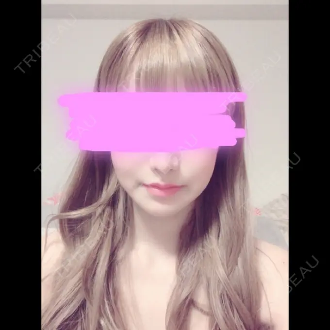 骨削り（エラ） / 骨削り（頬） / 目尻切開 / タレ目形成・グラマラスライン（切開） / 輪郭修正 / その他（輪郭） ウォンジン（Wonjin）整形外科 DAY 34 メイン用