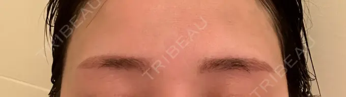 アートメイク（眉） 表参道メディカルクリニック 名古屋院 DAY 1 メイン用
