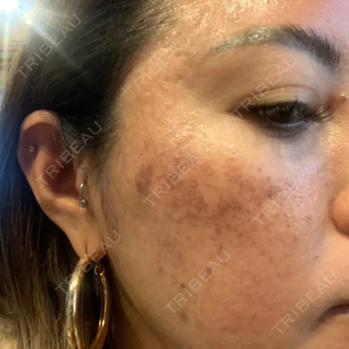 ルメッカ 豊洲内科・糖尿病 / 形成・美容外科クリニック DAY 0 メイン用