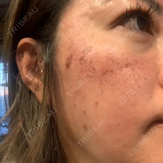 ルメッカ 豊洲内科・糖尿病 / 形成・美容外科クリニック AFTER メイン用