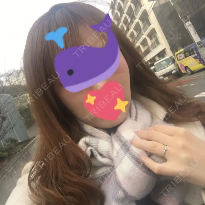 バッカルファット除去 / ボトックス（エラ・小顔） 湘南美容クリニック 秋葉原院 AFTER メイン用