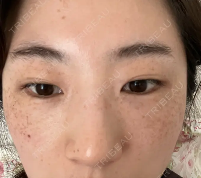 ルメッカ 豊洲内科・糖尿病 / 形成・美容外科クリニック AFTER メイン用