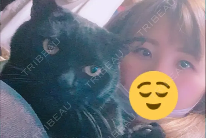 眼瞼下垂（切開） みずほクリニック DAY 73 メイン用