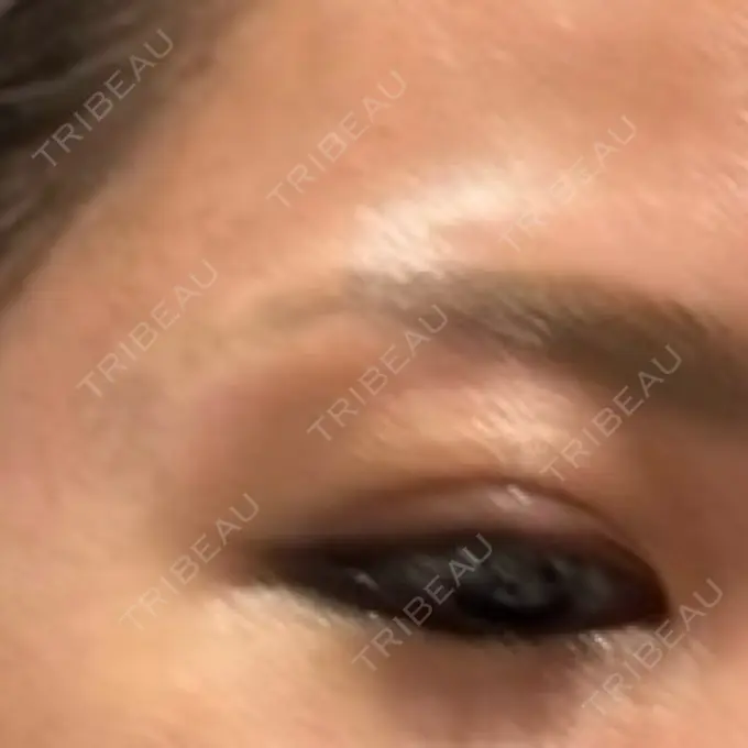 アートメイク（眉） 表参道メディカルクリニック 福岡天神院 AFTER メイン用