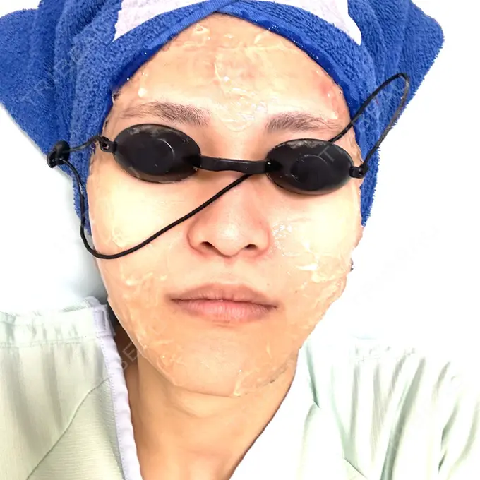 光治療（フォトフェイシャルなど） しらゆりメディカルクリニック （旧しらゆりビューティークリニック） DAY 0 メイン用