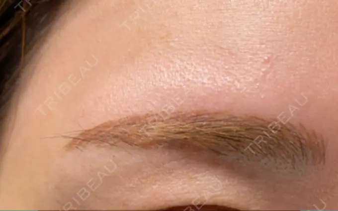 アートメイク（眉） 表参道メディカルクリニック 名古屋院 DAY 86 メイン用