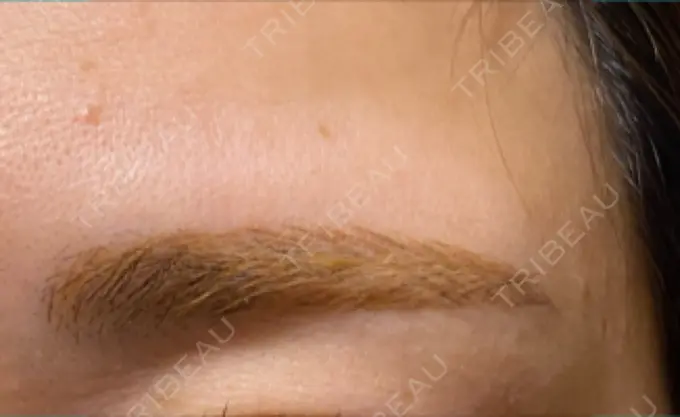 アートメイク（眉） 表参道メディカルクリニック 名古屋院 DAY 90 メイン用