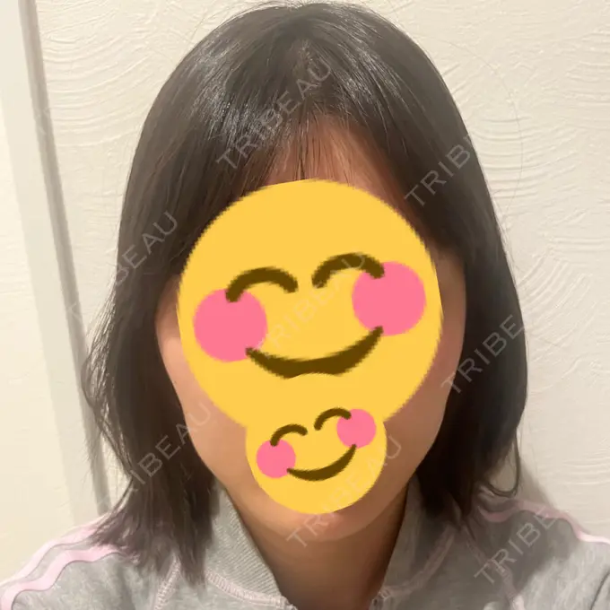 ボトックス（エラ・小顔） TCB東京中央美容外科 青森院 DAY 9 メイン用