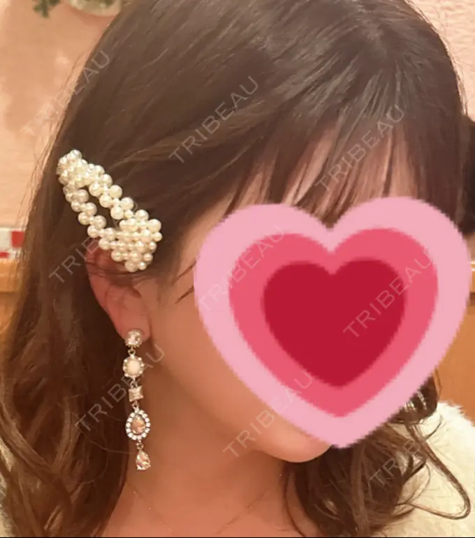 脂肪吸引（顔） / ジョールファット除去 / ボトックス（エラ・小顔） Otus Clinic 【オータスクリニック】 AFTER メイン用