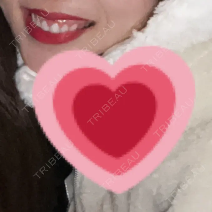 ガミースマイル手術 / 矯正（ワイヤー） / セラミック / その他（審美歯科/矯正歯科） 東京銀座A CLINIC デンタル DAY 408 メイン用