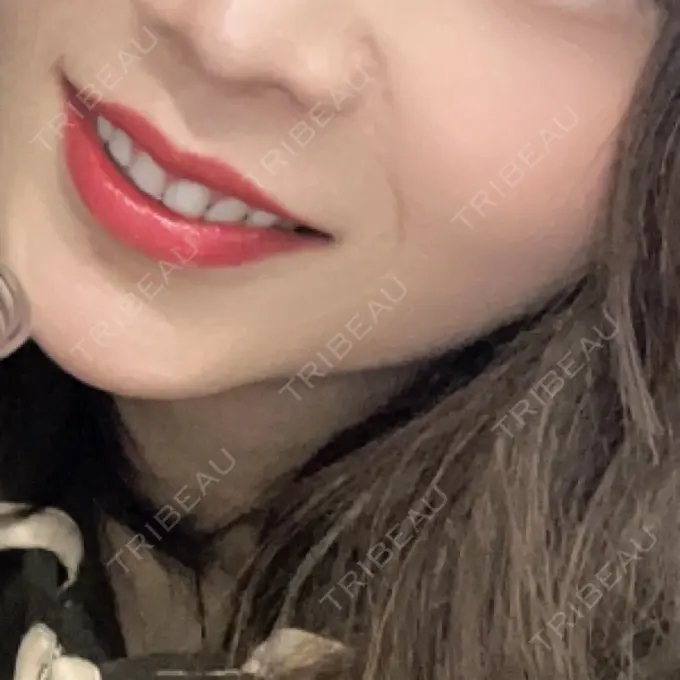 ガミースマイル手術 / 矯正（ワイヤー） / セラミック / その他（審美歯科/矯正歯科） 東京銀座A CLINIC デンタル DAY 419 メイン用