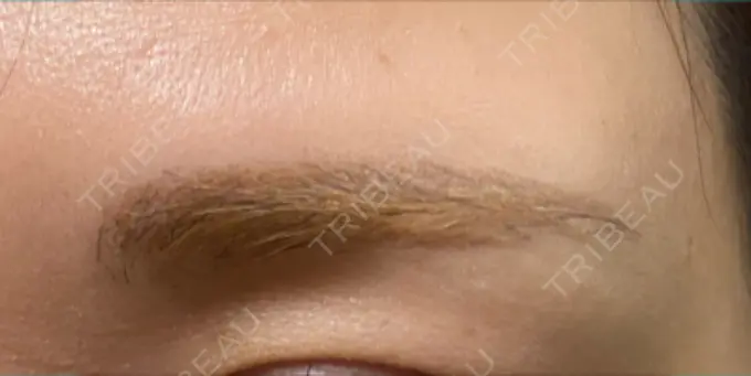 アートメイク（眉） 表参道メディカルクリニック 名古屋院 DAY 109 メイン用