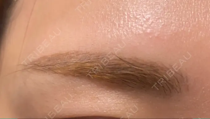 アートメイク（眉） 表参道メディカルクリニック 名古屋院 DAY 109 メイン用