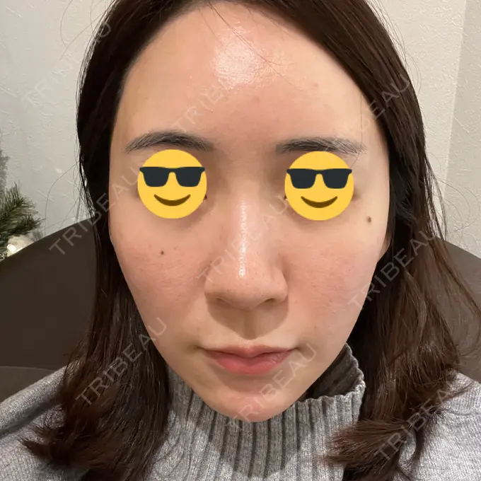 その他（肌） オールリティング整形外科 DAY 10 メイン用