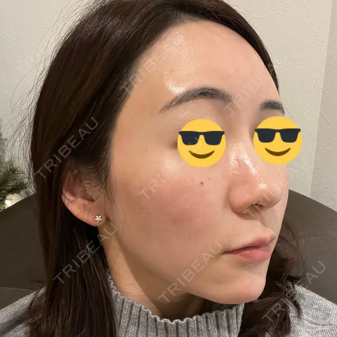 その他（肌） オールリティング整形外科 DAY 10 メイン用