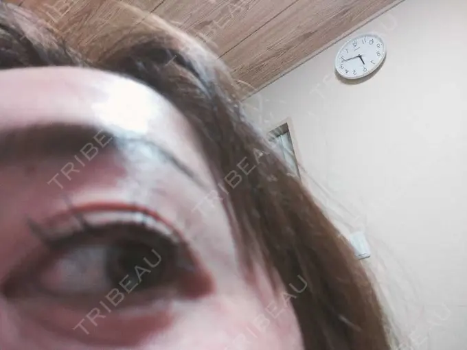 アートメイク（アイライン） Kinshicho Beauty Clinic （錦糸町ビューティークリニック） AFTER メイン用