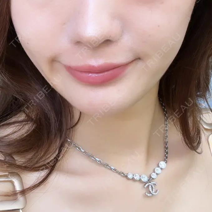 ヒアルロン酸注入（唇） / ボトックス（口角） フィラークリニック 渋谷院 DAY 0 メイン用