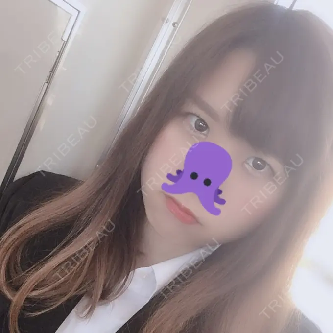 眼瞼下垂（切開） みずほクリニック DAY 80 メイン用