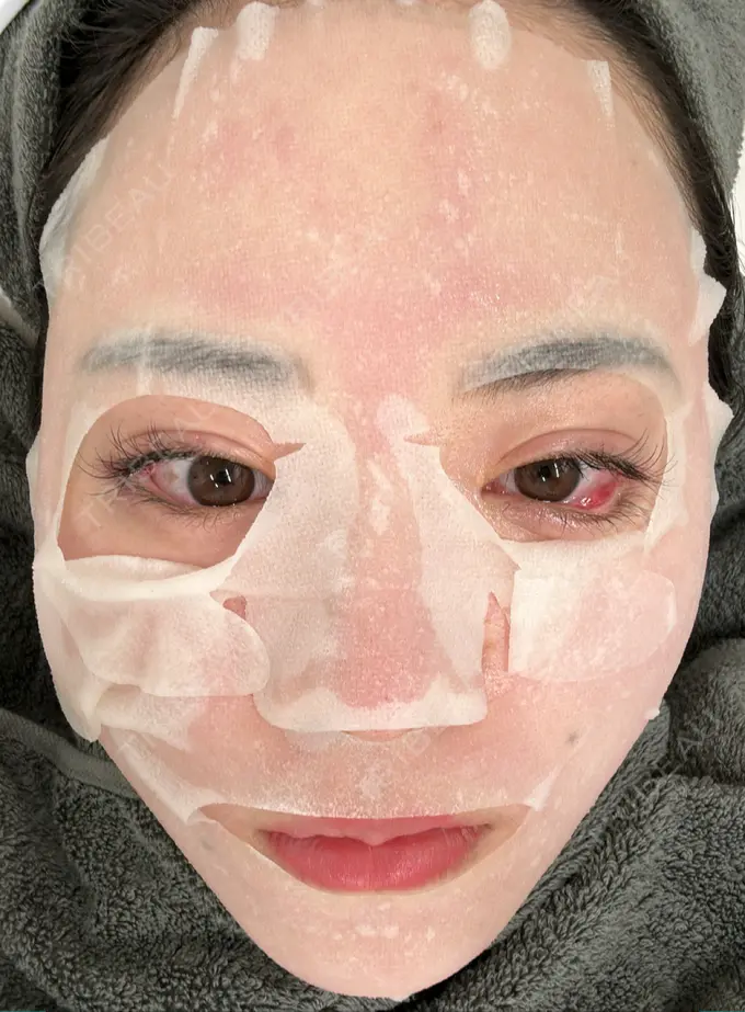 毛穴洗浄（ハイドラフェイシャルなど） / ヴェルヴェットスキン 日本美容・医療クリニック 六本木院 DAY 0 メイン用