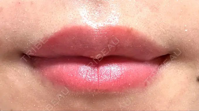 アートメイク（唇） Tokyo Tensei Clinic 新宿院 AFTER メイン用