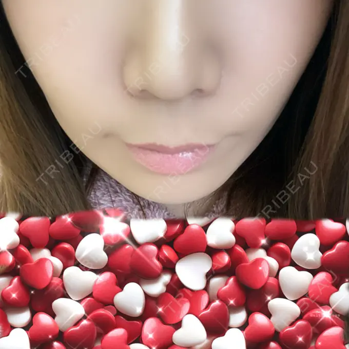 ボトックス（人中） veary clinic DAY 6 メイン用