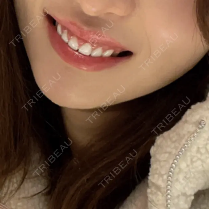 ガミースマイル手術 / 矯正（ワイヤー） / セラミック / その他（審美歯科/矯正歯科） 東京銀座A CLINIC デンタル DAY 463 メイン用