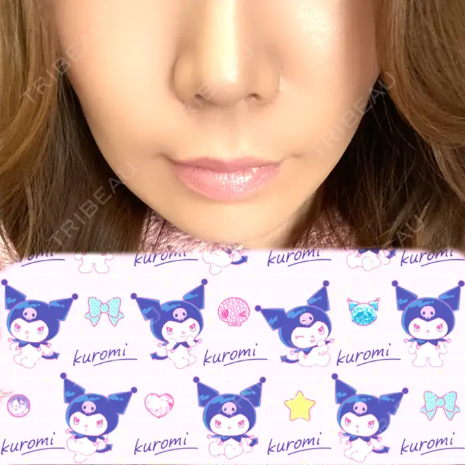 ボトックス（人中） veary clinic DAY 9 メイン用