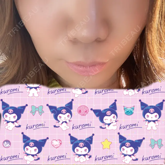 ボトックス（人中） veary clinic DAY 12 メイン用