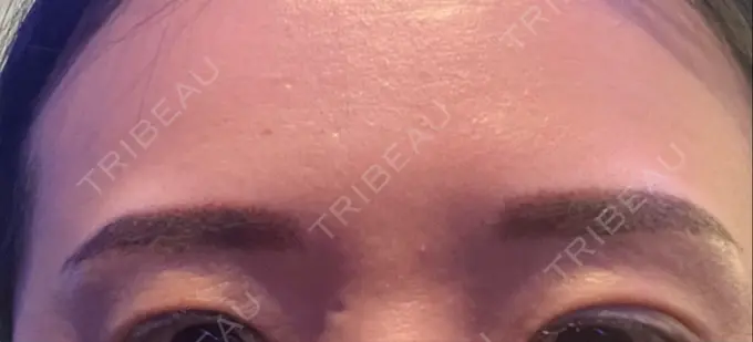 アートメイク（眉） Tokyo Tensei Clinic 新宿院 DAY 0 メイン用