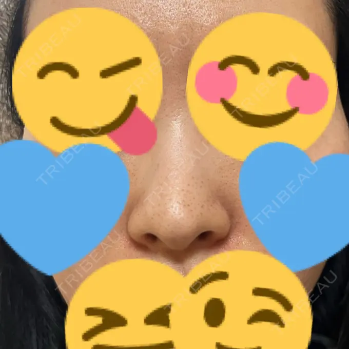 アグネス フェアクリニック川口 AFTER メイン用