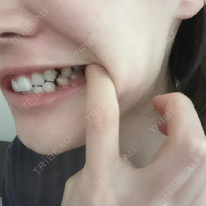 セットバック カトレア歯科・美容クリニック DAY 158 メイン用