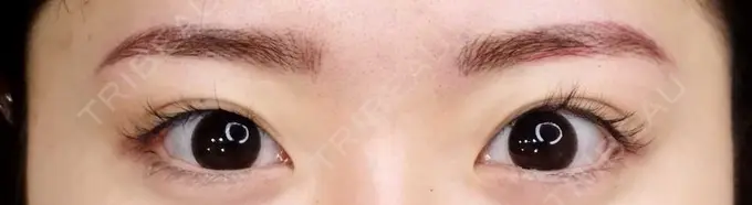 アートメイク（眉） MYCLINIC 西新宿 AFTER メイン用