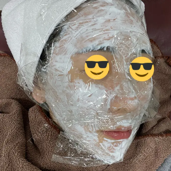 ニードルRF（ポテンツァなど） オラクル美容皮膚科 東京新宿院 DAY 0 メイン用