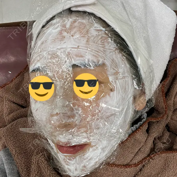 ニードルRF（ポテンツァなど） オラクル美容皮膚科 東京新宿院 DAY 0 メイン用