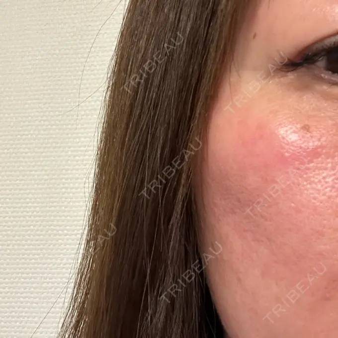 ポテンツァ 大垣美容クリニック AFTER メイン用