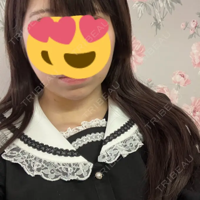 糸リフト / バッカルファット除去 / 脂肪吸引（顔） RIVER CLINIC（リバークリニック） DAY 5 メイン用