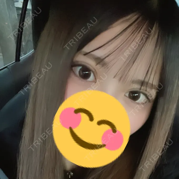 二重埋没 仙台TAクリニック AFTER メイン用