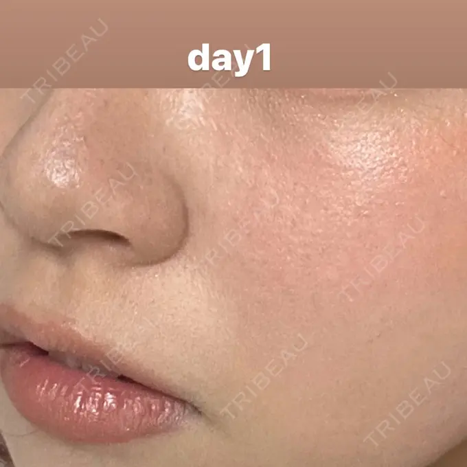 ポテンツァ 渋谷美容外科クリニック 渋谷院 AFTER メイン用