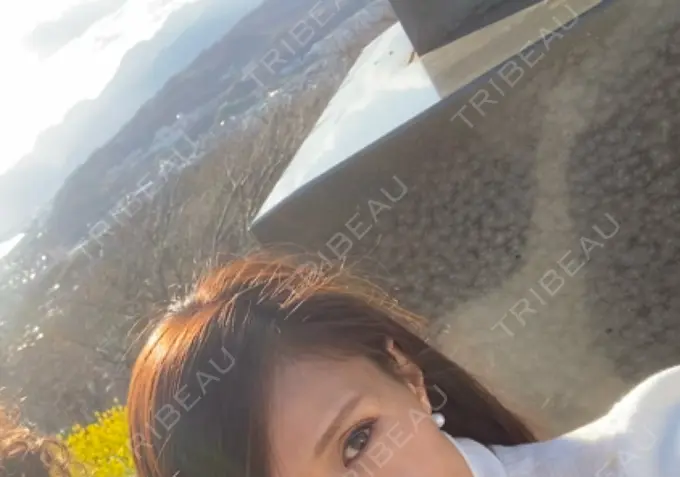 ボトックス（眉間） / ボトックス（目尻） 湘南美容クリニック 自由が丘院 DAY 3 メイン用