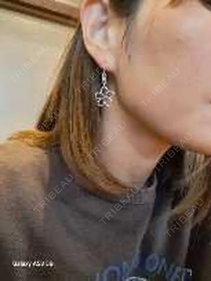 マイクロボトックス 日本美容・医療クリニック 六本木院 AFTER メイン用