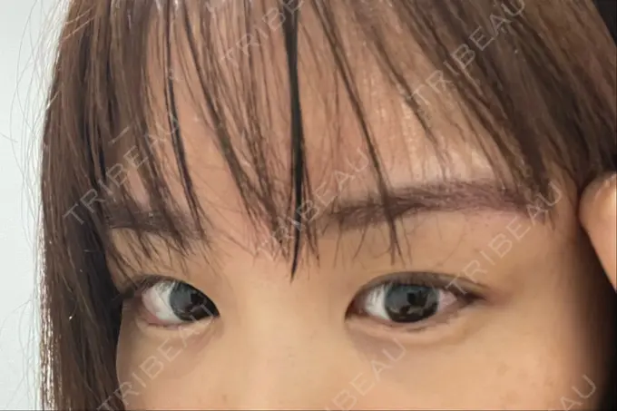 アートメイク（眉） 東京中央クリニック DAY 0 メイン用