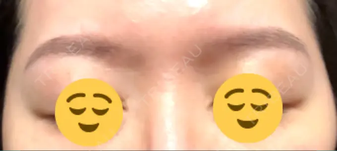 アートメイク（眉） MYCLINIC 西新宿 AFTER メイン用